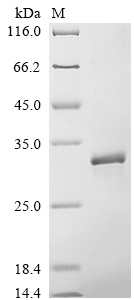 Recombinant Hepatitis B virus genotype A2 subtype adw2 Capsid protein (C)