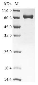Recombinant Human Insulin-like growth factor 2 mRNA-binding protein 3 (IGF2BP3)