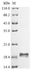 Recombinant Human T-cell surface glycoprotein CD3 gamma chain (CD3G), partial