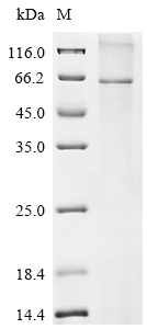 Recombinant Human Glucagon-like peptide 2 receptor (GLP2R)