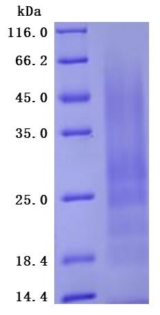 Recombinant Human Myosin regulatory light polypeptide 9 (MYL9) (Active)