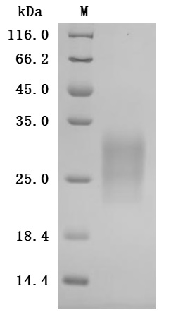 Recombinant Rat Gastric inhibitory polypeptide receptor (Gipr), partial (Active)