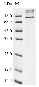 Recombinant Human E3 ubiquitin-protein ligase AMFR (AMFR)