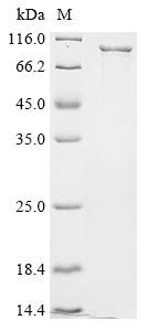 Recombinant Escherichia coli Ferrienterobactin receptor (fepA)