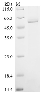 Recombinant Human 1-acylglycerol-3-phosphate O-acyltransferase PNPLA3 (PNPLA3), partial