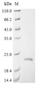 Recombinant Human Claudin-1 (CLDN1)