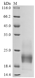 Recombinant Human T-cell immunoreceptor with Ig and ITIM domains (TIGIT), partial