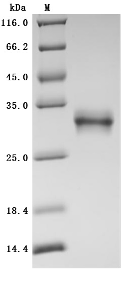 Recombinant Human Oncostatin-M (OSM), partial (Active)