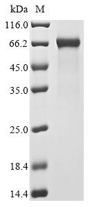 Recombinant Human High mobility group protein B1 (HMGB1)
