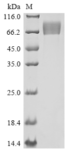 Recombinant Human Fibroblast growth factor receptor 1 (FGFR1), partial