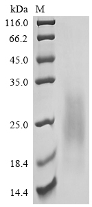 Recombinant Human Granulocyte-macrophage colony-stimulating factor (CSF2) (Active)