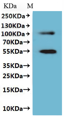 Recombinant Human Claudin-6 (CLDN6)-VLPs, Fluorescent (Active)