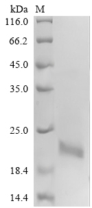 Recombinant Human Calcitonin gene-related peptide 1 (CALCA), partial