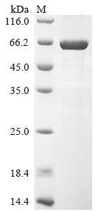 Recombinant Human CCR4-NOT transcription complex subunit 6-like (CNOT6L)