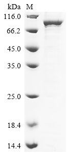 Recombinant Human Putative ATP-dependent RNA helicase DHX33 (DHX33)