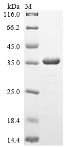 Recombinant Human Myosin regulatory light chain 12A (MYL12A)