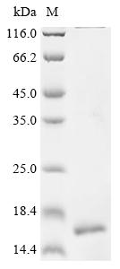 Recombinant Human CD9 antigen (CD9), partial