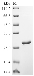 Recombinant Human Translationally-controlled tumor protein (TPT1)
