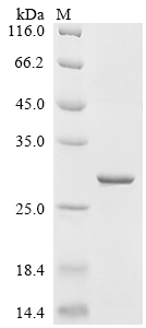 Recombinant Escherichia phage T7 T7 RNA polymerase (1), partial