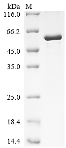 Recombinant Human Hyaluronan and proteoglycan link protein 1 (HAPLN1)