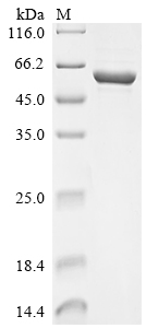 Recombinant Musa acuminata UTP--glucose-1-phosphate uridylyltransferase (UGPA)