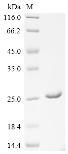 Recombinant Human Translationally-controlled tumor protein (TPT1)