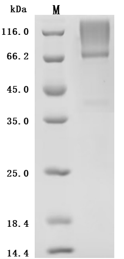 Recombinant Human Glypican-3 (GPC3)(S359F), partial (Active)