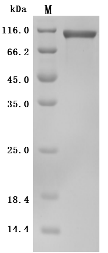 Recombinant Human Low affinity immunoglobulin gamma Fc region receptor III-A (FCGR3A)(F176V), partial (Active)
