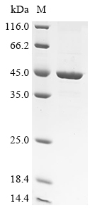 Recombinant Human Arylacetamide deacetylase (AADAC)