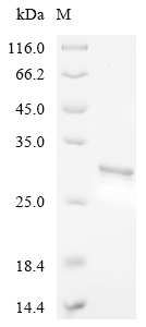 Recombinant Human NADH dehydrogenase [ubiquinone] 1 alpha subcomplex subunit 4 (NDUFA4), partial