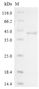 Recombinant Vaccinia virus Protein B5 (PS/HR), partial