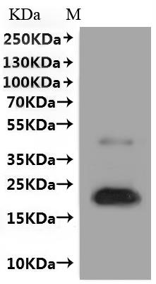 Recombinant Human Claudin-1 (CLDN1)-VLPs