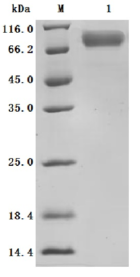 Recombinant Human Dipeptidase 3 (DPEP3), partial (Active)
