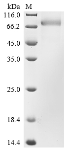 Recombinant Human Growth arrest-specific protein 6 (GAS6)