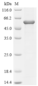 Recombinant Rabies virus Glycoprotein G (G), partial
