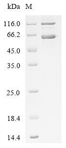 Recombinant Human Lysyl oxidase homolog 1 (LOXL1)