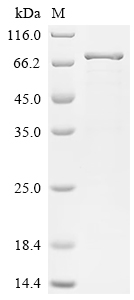 Recombinant Human Drebrin-like protein (DBNL)