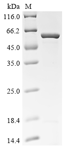 Recombinant Human CD9 antigen (CD9), partial, Biotinylated