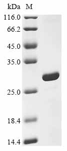 Recombinant Human NAD-dependent protein deacetylase sirtuin-3, mitochondrial (SIRT3), partial