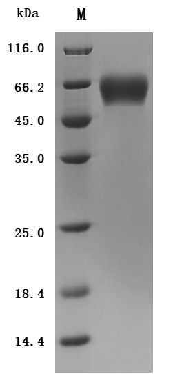 Recombinant Macaca fascicularis Interleukin 1 receptor accessory protein(IL1RAP), partial (Active)