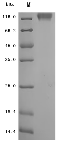 Recombinant Macaca mulatta Carcinoembryonic antigen-related cell adhesion molecule 5(CEACAM5), partial (Active)
