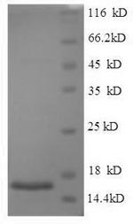 Human ACRV1 protein