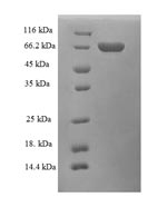 Human ADH5 protein