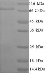Human AIFM1 protein
