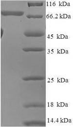 Human AKT2 protein