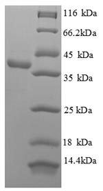 Human APEX1 protein