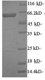 Human ARSB protein