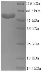 Human BCAT2 protein