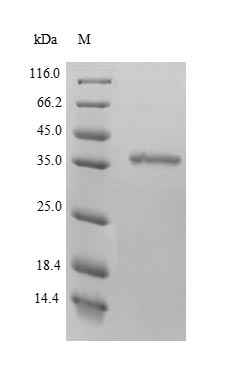 Human BDH1 BDH protein