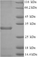 Mouse Birc5 protein